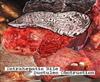 ladda ner album Biliary Cirrhosis - Intrahepatic Bile Ductules Obstruction
