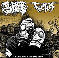 Download Tumor Ganas Fectus - Suburban Distortion